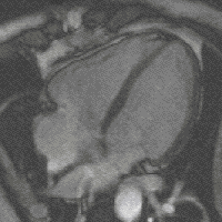 Magnetic resonance imaging