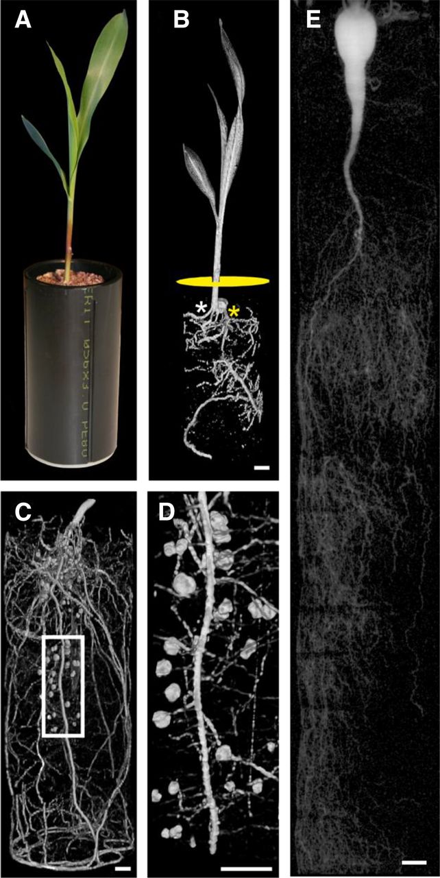 Magnetic resonance imaging