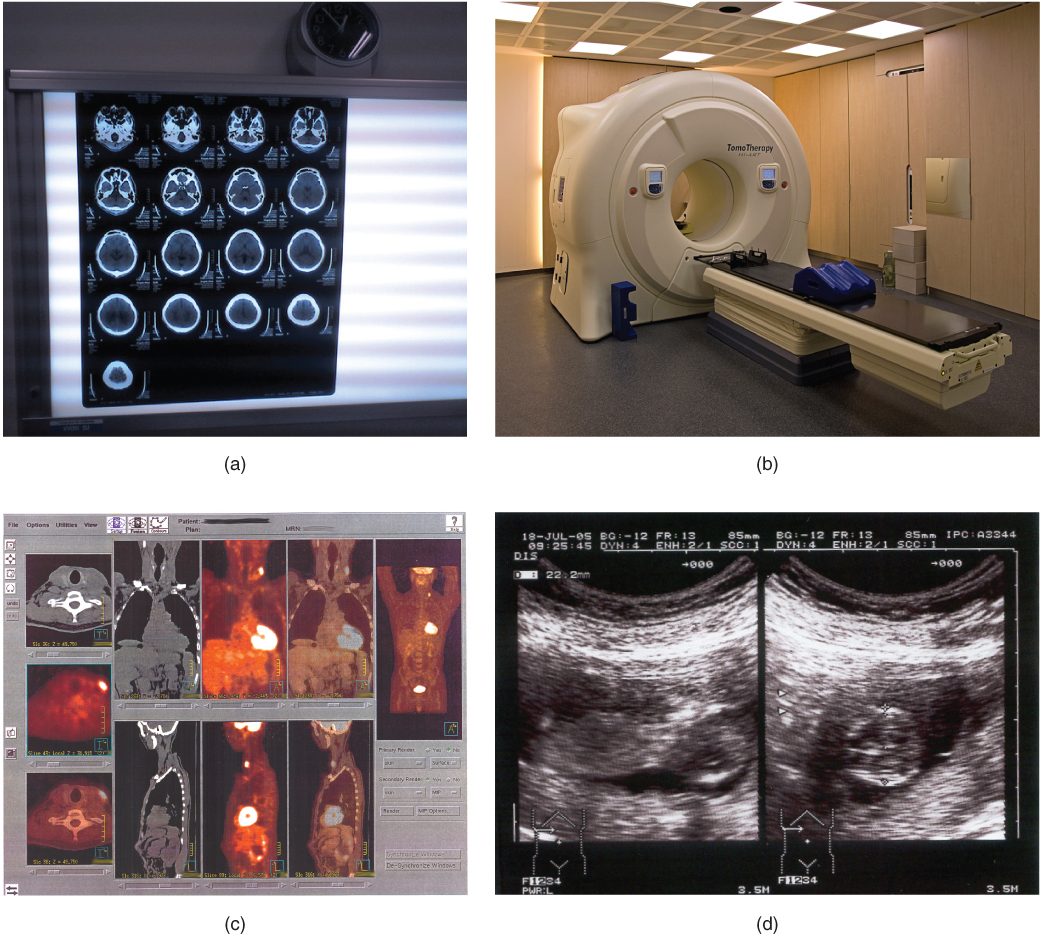 Medical imaging