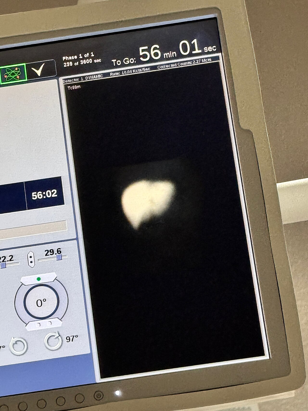 Medical imaging