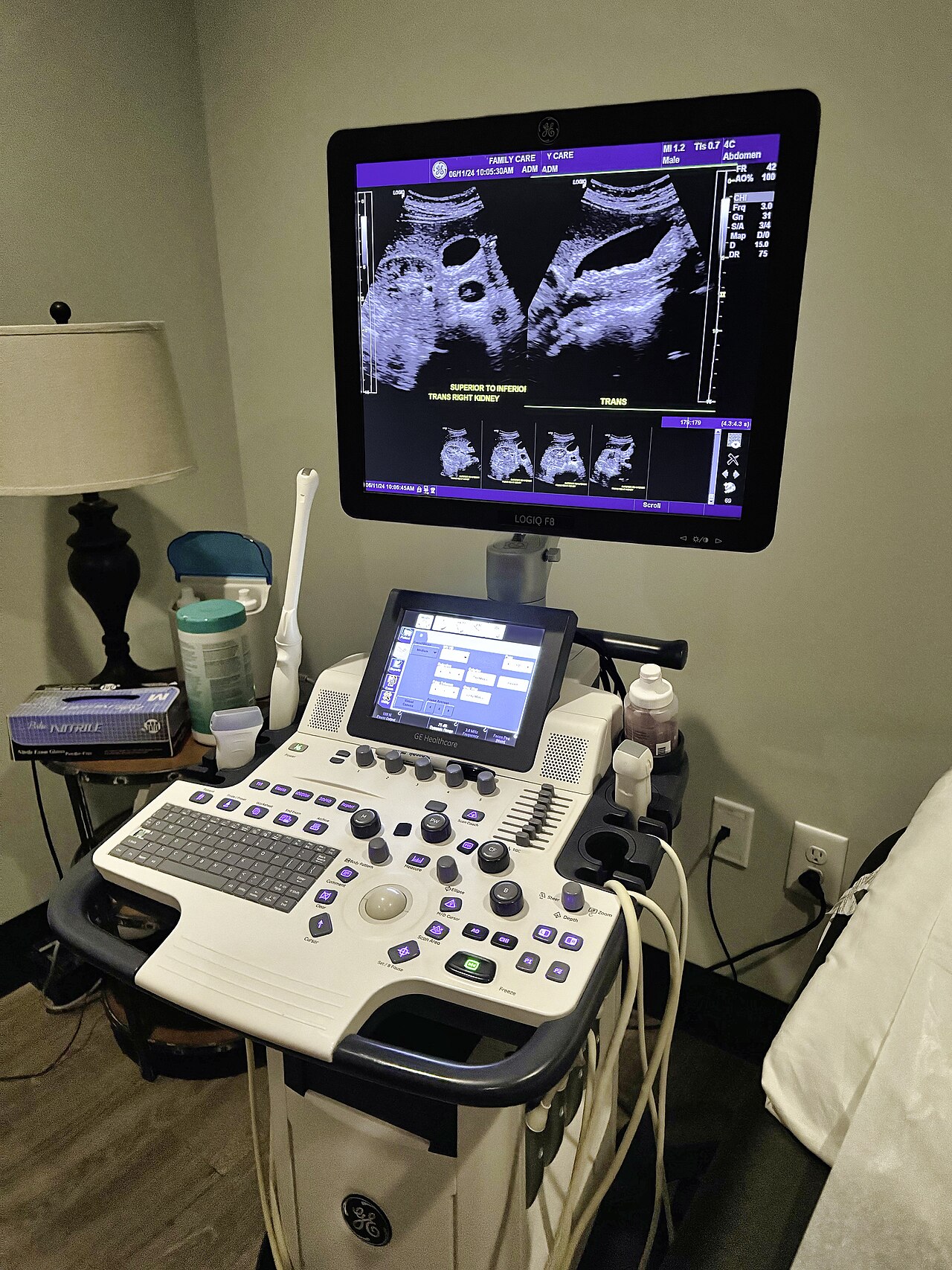 Medical ultrasound
