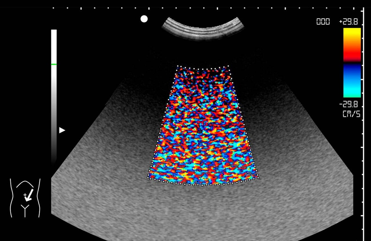 Medical ultrasound