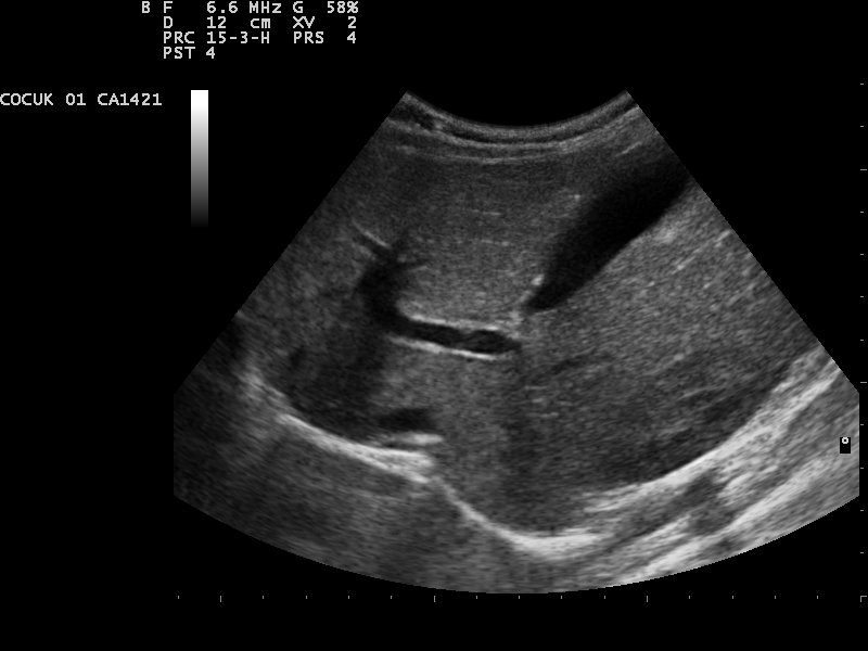 Medical ultrasound