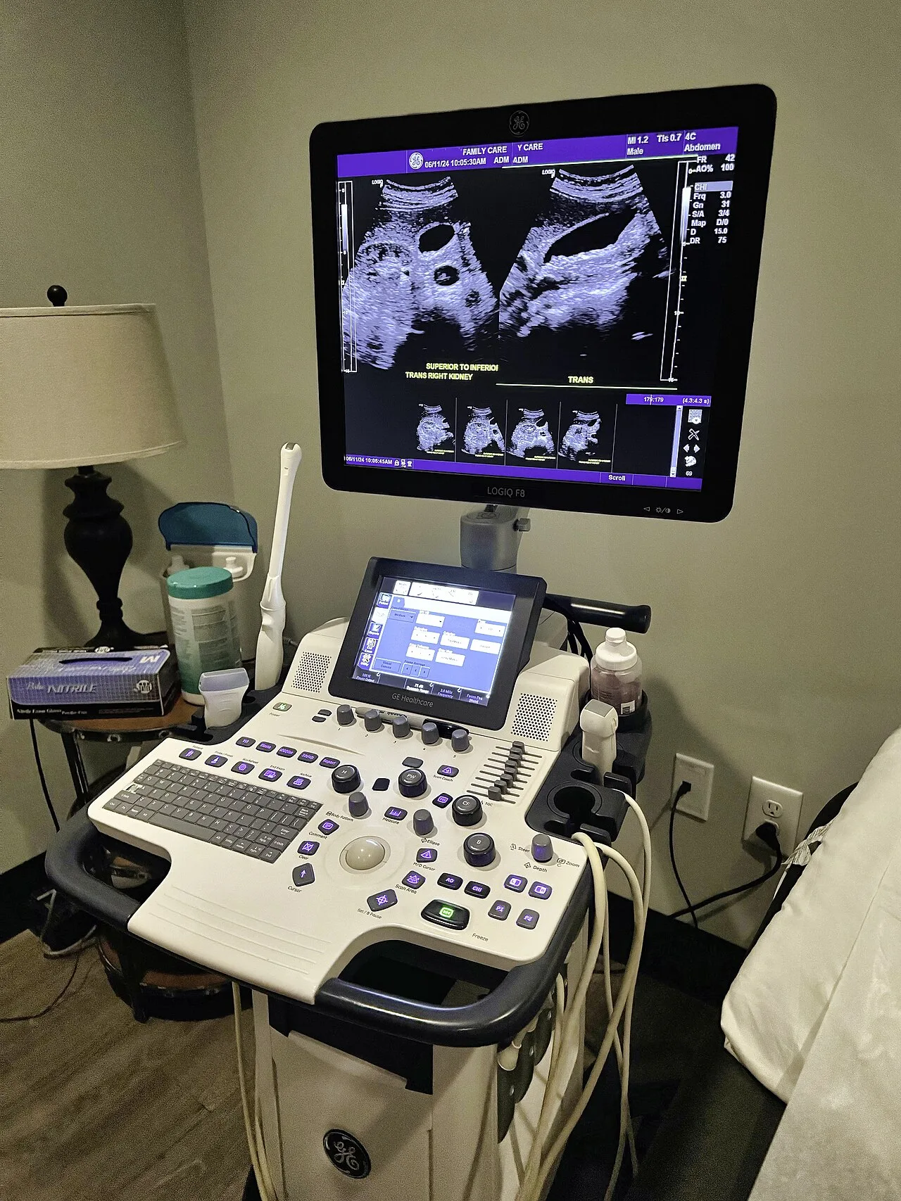 Medical ultrasound